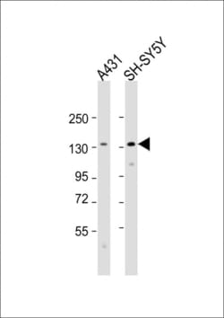 Invitrogen CDH4 Polyclonal Antibody 400 &mu;L | Buy Online | Invitrogen&trade; | Fisher Scientific