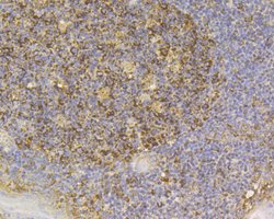 Invitrogen SLC8B1 Polyclonal Antibody 100 &mu;L | Buy Online | Invitrogen&trade; | Fisher Scientific