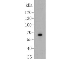 Invitrogen SLC8B1 Polyclonal Antibody 100 &mu;L | Buy Online | Invitrogen&trade; | Fisher Scientific