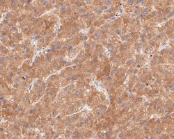 Invitrogen KCNK2 Polyclonal Antibody 100 &mu;L; Unconjugated:Antibodies,