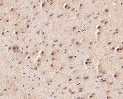Invitrogen KCNK2 Polyclonal Antibody 100 &mu;L; Unconjugated:Antibodies,