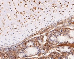Invitrogen KCNK2 Polyclonal Antibody 100 &mu;L; Unconjugated:Antibodies,
