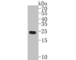 Invitrogen C19orf63 Polyclonal Antibody 100 &mu;L | Buy Online | Invitrogen&trade; | Fisher Scientific