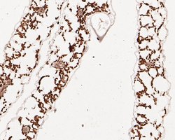 Invitrogen AP4E1 Polyclonal Antibody 100 &mu;L; Unconjugated:Antibodies,