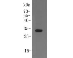 Invitrogen CCDC90A Polyclonal Antibody 100 &mu;L | Buy Online | Invitrogen&trade; | Fisher Scientific