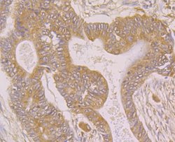 Invitrogen SPATA13 Polyclonal Antibody 100 &mu;L; Unconjugated:Antibodies,