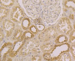Invitrogen SPATA13 Polyclonal Antibody 100 &mu;L; Unconjugated:Antibodies,
