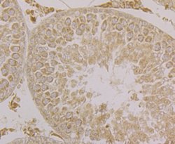 Invitrogen SPATA13 Polyclonal Antibody 100 &mu;L; Unconjugated:Antibodies,