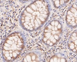 Invitrogen KCNN2 Polyclonal Antibody 100 &mu;L; Unconjugated:Antibodies,