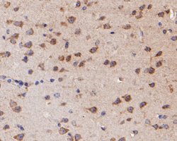 Invitrogen KCNN2 Polyclonal Antibody 100 &mu;L; Unconjugated:Antibodies,