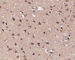 Invitrogen KCNN2 Polyclonal Antibody 100 &mu;L; Unconjugated:Antibodies,