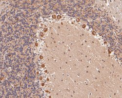 Invitrogen KCNN2 Polyclonal Antibody 100 &mu;L; Unconjugated:Antibodies,