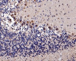 Invitrogen KCNN2 Polyclonal Antibody 100 &mu;L; Unconjugated:Antibodies,