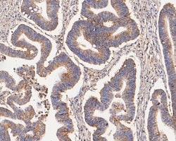 Invitrogen KCNK9 Polyclonal Antibody 100 &mu;L; Unconjugated:Antibodies,