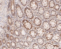 Invitrogen KCNK9 Polyclonal Antibody 100 &mu;L; Unconjugated:Antibodies,