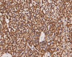 Invitrogen KCNK9 Polyclonal Antibody 100 &mu;L; Unconjugated:Antibodies,