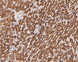 Invitrogen KCNK9 Polyclonal Antibody 100 &mu;L; Unconjugated:Antibodies,