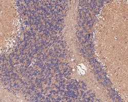 Invitrogen KCNK9 Polyclonal Antibody 100 &mu;L; Unconjugated:Antibodies,