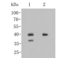 Invitrogen Nkx2.1 Polyclonal Antibody 100 &mu;L; Unconjugated:Antibodies,