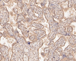 Invitrogen SLC12A9 Polyclonal Antibody 100 &mu;L | Buy Online | Invitrogen&trade; | Fisher Scientific