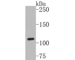 Invitrogen SLC12A9 Polyclonal Antibody 100 &mu;L | Buy Online | Invitrogen&trade; | Fisher Scientific
