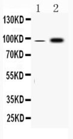 Invitrogen Fibrinogen alpha chain Polyclonal Antibody 100 &mu;g | Buy Online | Invitrogen&trade; | Fisher Scientific