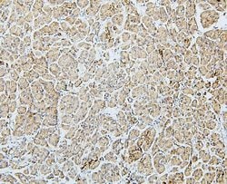 Invitrogen MTR Polyclonal Antibody 100 &mu;g; Unconjugated:Antibodies,
