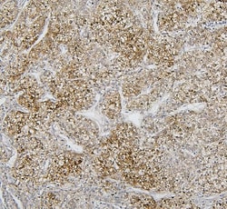 Invitrogen CYP2C19 Polyclonal Antibody 100 &mu;g; Unconjugated:Antibodies,
