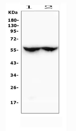 Invitrogen CYP2C19 Polyclonal Antibody 100 &mu;g; Unconjugated:Antibodies,