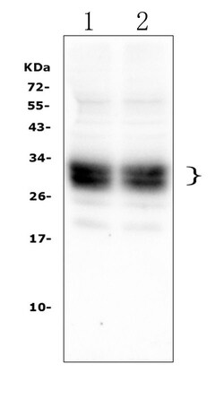 Invitrogen Cd8a Polyclonal Antibody 100 &mu;g | Buy Online | Invitrogen&trade; | Fisher Scientific