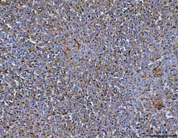 Invitrogen MRC1 Polyclonal Antibody 100 &mu;g; Unconjugated:Antibodies,