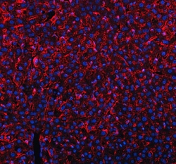 Invitrogen MRC1 Polyclonal Antibody 100 &mu;g; Unconjugated:Antibodies,