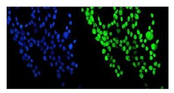 Invitrogen NUP214 Polyclonal Antibody 100 &mu;g; Unconjugated:Antibodies,