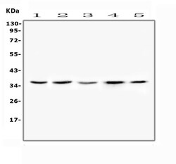 Invitrogen FRZB Polyclonal Antibody 100 &mu;g; Unconjugated:Antikroppar