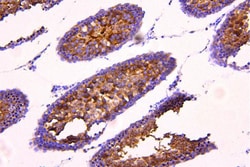 Invitrogen ACACB Polyclonal Antibody 100 &mu;g; Unconjugated:Antibodies,