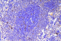 Invitrogen SCN11A Polyclonal Antibody 100 μg; Unconjugated:Antibodies,