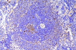 Invitrogen SCN11A Polyclonal Antibody 100 μg; Unconjugated:Antibodies,