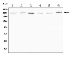 Invitrogen SCN11A Polyclonal Antibody 100 μg; Unconjugated:Antibodies,