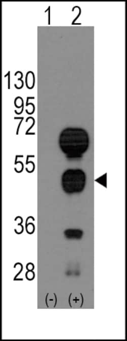 Invitrogen GATA4 Polyclonal Antibody 400 &mu;L; Unconjugated:Antibodies,
