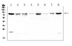 Invitrogen POMT2 Polyclonal Antibody 100 &mu;g | Buy Online | Invitrogen&trade; | Fisher Scientific