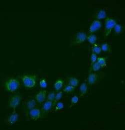 Invitrogen SEMA3B Polyclonal Antibody 100 &mu;g; Unconjugated:Antibodies,