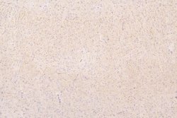 Invitrogen SEMA3B Polyclonal Antibody 100 &mu;g; Unconjugated:Antibodies,