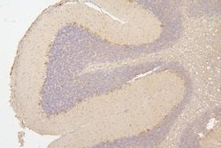 Invitrogen SEMA3B Polyclonal Antibody 100 &mu;g; Unconjugated:Antibodies,