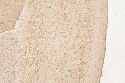 Invitrogen SEMA3B Polyclonal Antibody 100 &mu;g; Unconjugated:Antibodies,