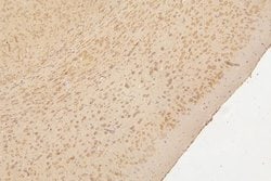 Invitrogen SEMA3B Polyclonal Antibody 100 &mu;g; Unconjugated:Antibodies,