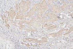 Invitrogen SEMA3B Polyclonal Antibody 100 &mu;g; Unconjugated:Antibodies,