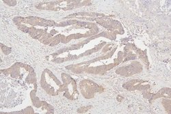 Invitrogen SEMA3B Polyclonal Antibody 100 &mu;g; Unconjugated:Antibodies,
