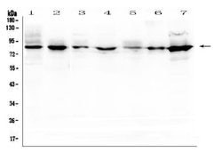 Invitrogen SEMA3B Polyclonal Antibody 100 &mu;g; Unconjugated:Antibodies,