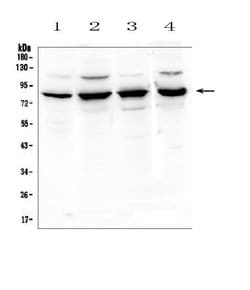Invitrogen SEMA3B Polyclonal Antibody 100 &mu;g; Unconjugated:Antibodies,