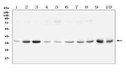 Invitrogen GPD1L Polyclonal Antibody 100 &mu;g; Unconjugated:Antibodies,